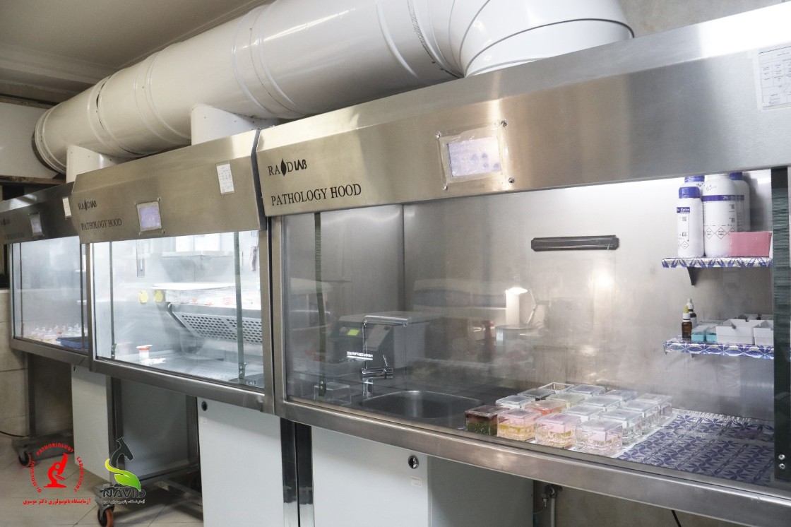 Laminar Flow Hood Classll -B2
