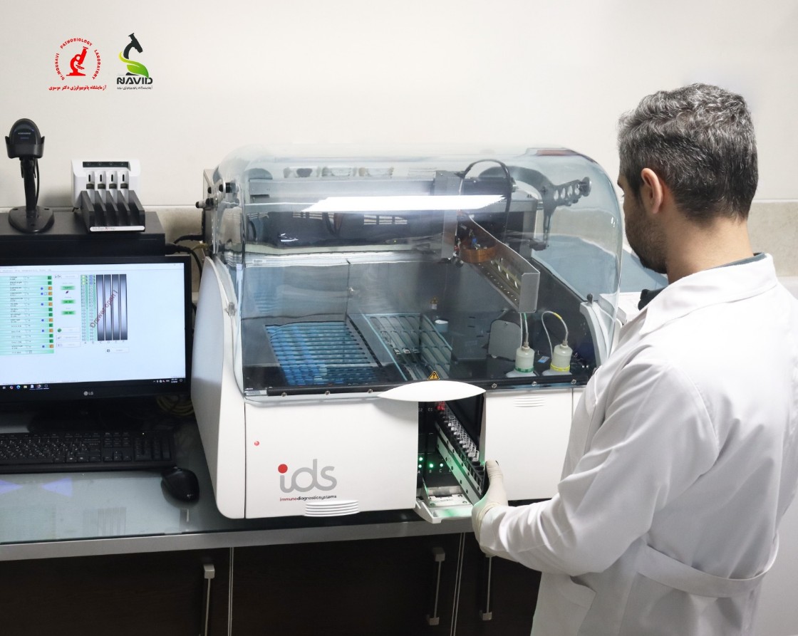 IDS-iSYS  Immunoanalyzer