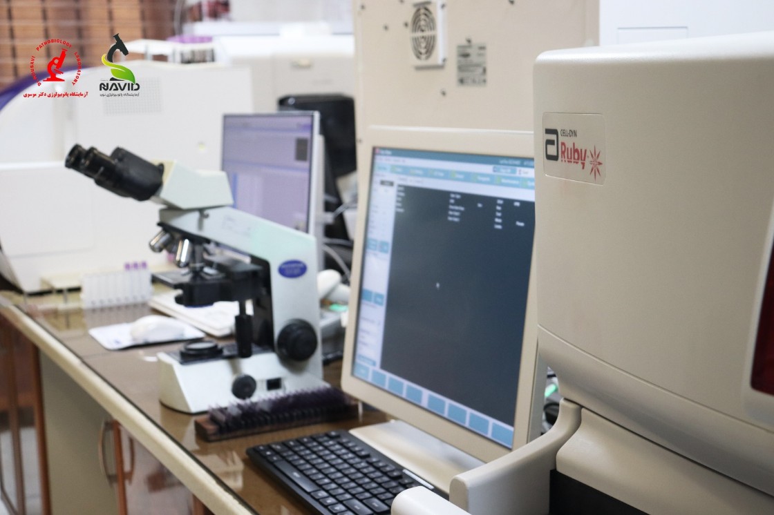 دستگاه Abbott Ruby Cell Counter